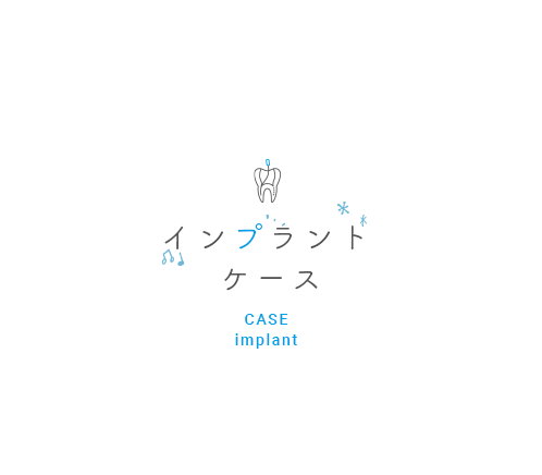 審美治療ケース